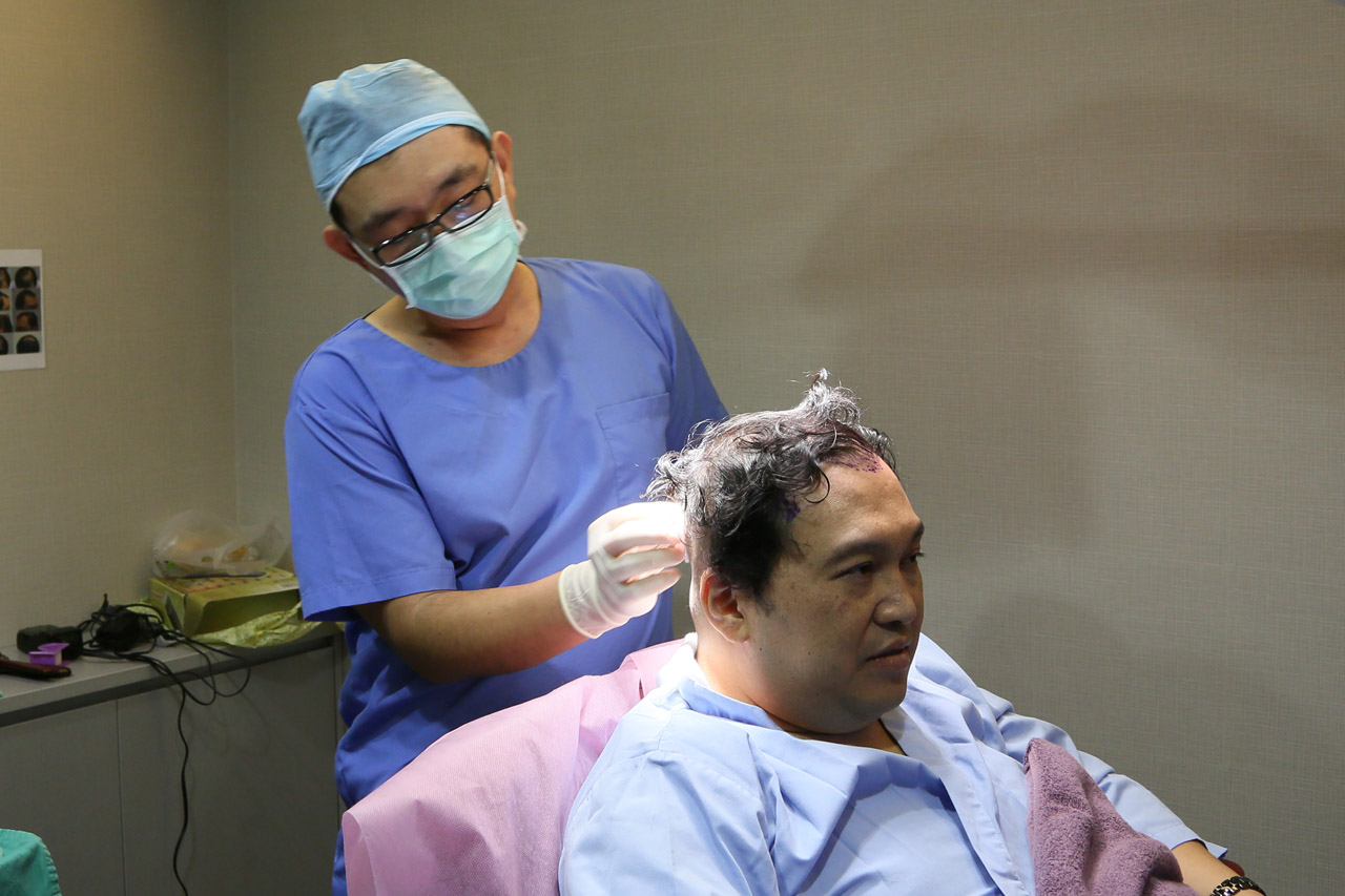 李定樊,楊名權,ARTAS,植髮機器人,植髮